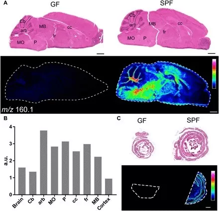 MALDI-MSI on brain and gut sections from C57BL/6 GF and SPF mice (Hulme et al., 2020)